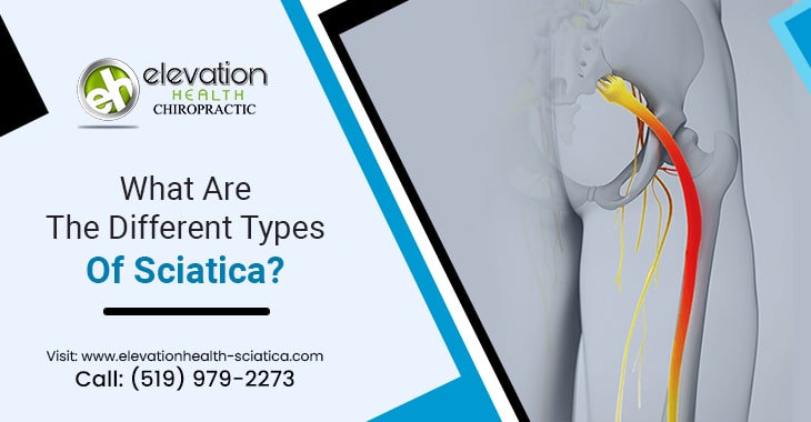 What Are The Different Types Of Sciatica?